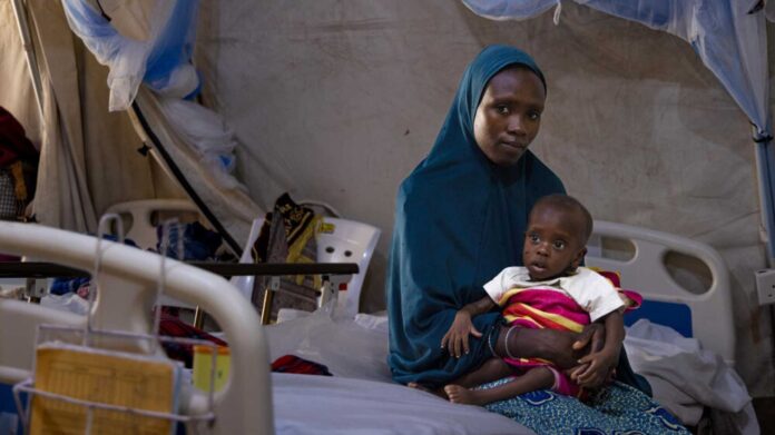 Severe Malnutrition In Northern Nigeria Msf