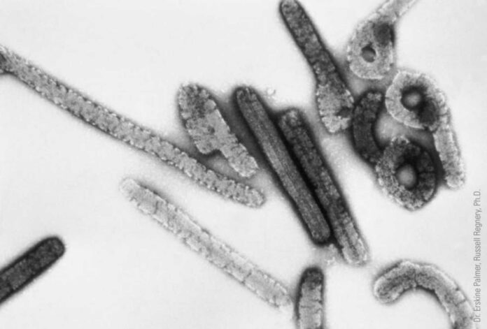 Marburg Virus Outbreak In Rwanda