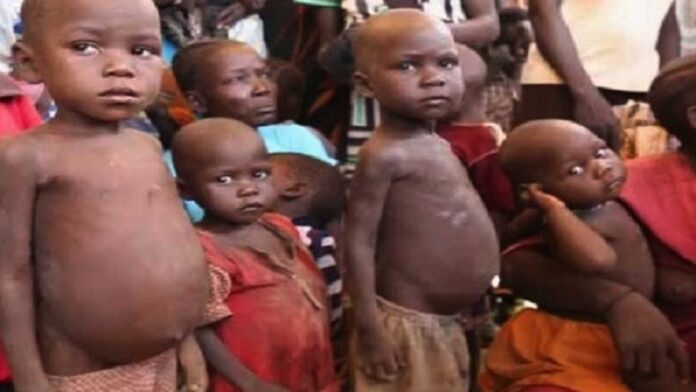 Malnutrition Crisis Children Nigeria